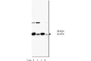 Western Blotting (WB) image for anti-N-Ethylmaleimide-Sensitive Factor Attachment Protein, alpha (NAPA) antibody (ABIN264390) (NAPA Antikörper)