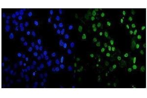 IF analysis of MDC1 using anti-MDC1 antibody (ABIN5693232).