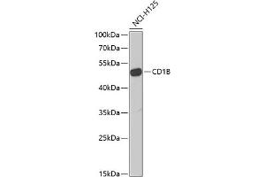 Western blot analysis of extracts of NCI-H125 cells, using CD1B Antibody (ABIN6130059, ABIN6138133, ABIN6138134 and ABIN6222219) at 1:1000 dilution. (CD1b Antikörper  (AA 18-303))