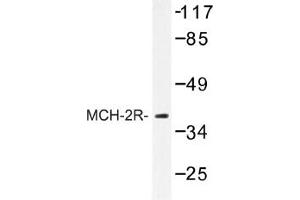 Image no. 1 for anti-Melanin-Concentrating Hormone Receptor 2 (MCHR2) antibody (ABIN317652)