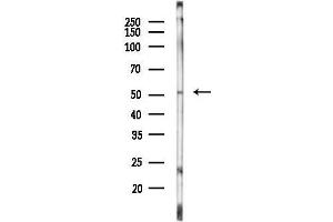anti-Vasoactive Intestinal Peptide Receptor 1 (VIPR1) (Internal Region) antibody