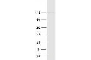 ERN1 Protein (Myc-DYKDDDDK Tag)