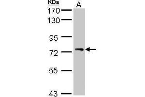 Western Blotting (WB) image for anti-Signal Transducing Adaptor Molecule (SH3 Domain and ITAM Motif) 1 (STAM) (Center) antibody (ABIN2856220)