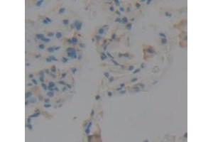 IHC-P analysis of Human Tissue, with DAB staining. (Peroxidasin Antikörper  (AA 1285-1475))