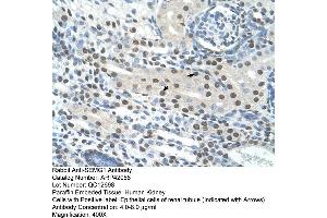 Rabbit Anti-SEMG1 Antibody  Paraffin Embedded Tissue: Human Kidney Cellular Data: Epithelial cells of renal tubule Antibody Concentration: 4. (SEMG1 Antikörper  (N-Term))