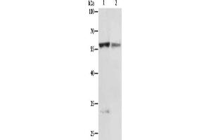 Gel: 10 % SDS-PAGE, Lysate: 50 μg, Lane 1-2: Jurkat cells, human fetal liver tissue, Primary antibody: ABIN7130695(PRCP Antibody) at dilution 1/200, Secondary antibody: Goat anti rabbit IgG at 1/8000 dilution, Exposure time: 5 minutes (PRCP Antikörper)
