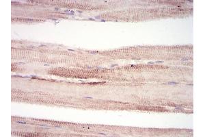 Immunohistochemical analysis of paraffin-embedded muscle tissues using MuRF1 mouse mAb with DAB staining.