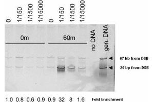 Image no. 1 for anti-MRE11 Meiotic Recombination 11 Homolog A (S. Cerevisiae) (MRE11A) (AA 578-590) antibody (ABIN401304) (Mre11 Antikörper  (AA 578-590))