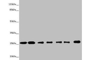 Western blot All lanes: RALB antibody at 1. (RALB Antikörper  (AA 1-206))