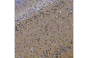 IHC analysis of TOM1L1 using anti-TOM1L1 antibody (ABIN7602631). (TOM1L1 Antikörper  (AA 9-448))