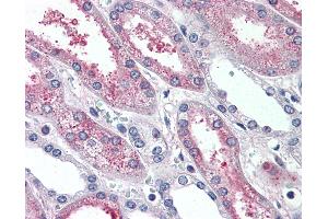 Anti-SUSD2 antibody IHC of human kidney. (SUSD2 Antikörper  (Internal Region))
