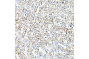 Immunohistochemistry (Paraffin-embedded Sections) (IHC (p)) image for anti-Arrestin, beta 1 (ARRB1) (AA 169-418) antibody (ABIN3021265)