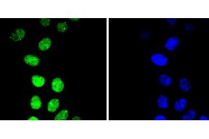 HepG2 cells were stained with Cyclin E1(T77) (4G10 ) Monoclonal Antibody  at [1:200] incubated overnight at 4C, followed by secondary antibody incubation, DAPI staining of the nuclei and detection. (Cyclin E1 Antikörper  (pThr77))