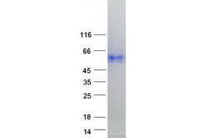 Western Blotting (WB) image for Transmembrane Protease, serine 4 (TMPRSS4) (Transcript Variant 3) protein (Myc-DYKDDDDK Tag) (ABIN2733925)