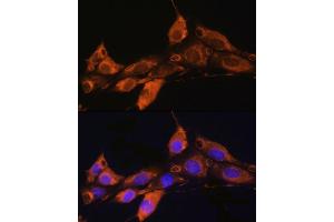 Immunofluorescence analysis of NIH/3T3 cells using  Rabbit pAb (ABIN7265482) at dilution of 1:100. (ARF4 Antikörper  (AA 1-180))