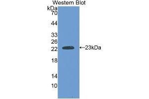 Western Blotting (WB) image for anti-Slow Skeletal Troponin I (TNNI1) (AA 142-187) antibody (ABIN1176053) (TNNI1 Antikörper  (AA 142-187))