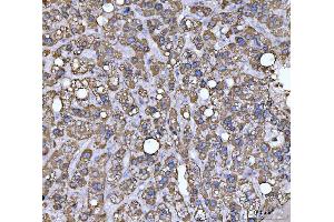 IHC analysis of ECHS1 using anti-ECHS1 antibody (ABIN7599813).