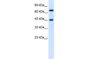 Western Blotting (WB) image for anti-TOX High Mobility Group Box Family Member 2 (TOX2) antibody (ABIN2460145)