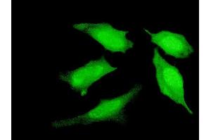 Immunofluorescence of monoclonal antibody to PRDM4 on HeLa cell. (PRDM4 Antikörper  (AA 476-575))