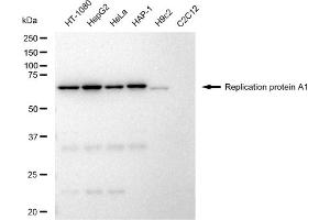 Western blotting analysis using Replication protein A1 antibody (ABIN7800172).