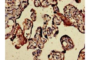 Immunohistochemistry of paraffin-embedded human placenta tissue using ABIN7145708 at dilution of 1:100 (BMPR1B Antikörper  (AA 14-126))