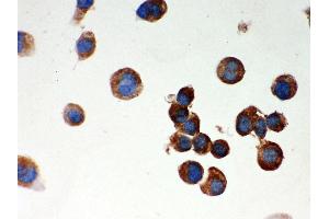 Anti- Parkin Picoband antibody, ICC ICC: NEURO-2α Cell