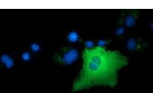 Anti-ARHGAP25 mouse monoclonal antibody (ABIN2452769) immunofluorescent staining of COS7 cells transiently transfected by pCMV6-ENTRY ARHGAP25 (RC217414). (ARHGAP25 Antikörper)