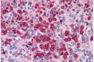 Spleen, Human: Formalin-Fixed, Paraffin-Embedded (FFPE) (ELANE Antikörper)