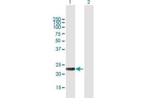 Western Blot analysis of MED20 expression in transfected 293T cell line by MED20 MaxPab polyclonal antibody. (MED20 Antikörper  (AA 1-212))