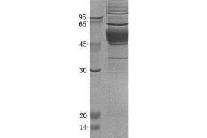 Western Blotting (WB) image for Lipoprotein-Associated phospholipase A2 (Lp-PLA2) (Transcript Variant 2) protein (His tag) (ABIN2729086)