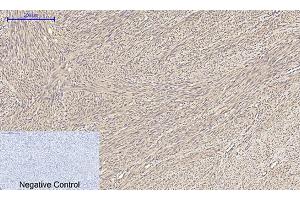 Immunohistochemical analysis of paraffin-embedded human uterus tissue. (alpha Tubulin Antikörper  (AA 380-460))