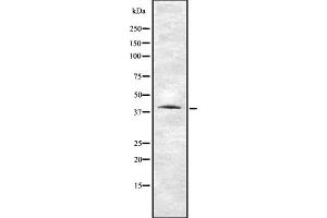 Western blot analysis of VN1R1 using HUVEC whole cell lysates (VN1R1 Antikörper  (N-Term))