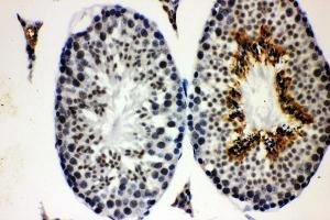 IHC analysis of CCNE1 using anti-CCNE1 antibody (ABIN7601193). (Cyclin E1 Antikörper  (AA 3-386))