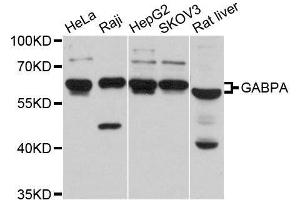 Western blot analysis of extracts of various cell lines, using GABPA antibody. (GABPA Antikörper  (AA 1-100))