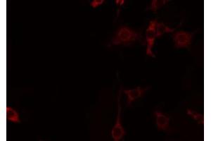 ABIN6274451 staining Hela by IF/ICC. (CNKSR2 Antikörper  (Internal Region))
