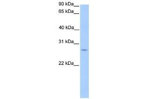 anti-Similar To TBP-Associated Factor 11 (LOC391766) (Middle Region) antibody