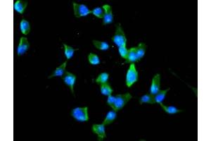 Immunofluorescence staining of SH-SY5Y cells with ABIN7168374 at 1:100, counter-stained with DAPI. (MEX3B Antikörper  (AA 253-375))