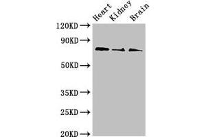 Western Blot Positive WB detected in: Mouse heart tissue, Mouse kidney tissue, Mouse brain tissue All lanes: SLC5A1 antibody at 4 μg/mL Secondary Goat polyclonal to rabbit IgG at 1/50000 dilution Predicted band size: 74, 61 kDa Observed band size: 74 kDa (SLC5A1 Antikörper  (AA 564-643))