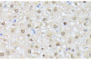 Immunohistochemistry of paraffin-embedded Rat liver using CSNK2A1 Polyclonal Antibody at dilution of 1:100 (40x lens). (CSNK2A1/CK II alpha Antikörper)