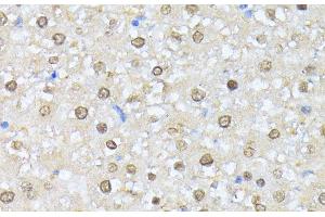 Immunohistochemistry of paraffin-embedded Rat liver using CSNK2A1 Polyclonal Antibody at dilution of 1:100 (40x lens).
