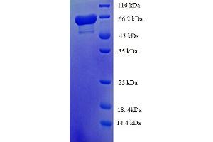 SDS-PAGE (SDS) image for Aldehyde Dehydrogenase 5 Family, Member A1 (ALDH5A1) (AA 48-535) protein (His-SUMO Tag) (ABIN5709037)