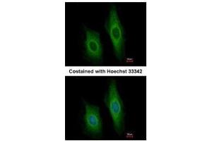 ICC/IF Image Immunofluorescence analysis of methanol-fixed HeLa, using DNase I, antibody at 1:200 dilution.