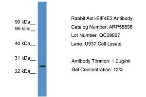 WB Suggested Anti-EIF4E2  Antibody Titration: 0. (EIF4E2 Antikörper  (N-Term))
