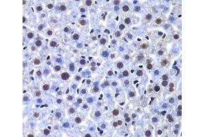 Immunohistochemistry of paraffin-embedded Mouse liver using PRKDC Polyclonal Antibody at dilution of 1:100 (40x lens). (PRKDC Antikörper)