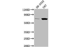 Western Blot Positive WB detected in: SH-SY5Y whole cell lysate, U87 whole cell lysate All lanes: TP73 antibody at 1:2000 Secondary Goat polyclonal to rabbit IgG at 1/50000 dilution Predicted band size: 70, 55, 54, 45, 62, 60, 65, 50, 48, 63, 39 kDa Observed band size: 70 kDa (Tumor Protein p73 Antikörper  (AA 537-555))