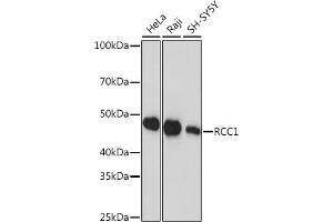 Western blot analysis of extracts of various cell lines, using RCC1 Rabbit mAb (ABIN1512845, ABIN3021028, ABIN3021029 and ABIN7101332) at 1:1000 dilution. (RCC1 Antikörper)