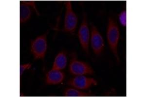 Image no. 3 for anti-Mechanistic Target of Rapamycin (serine/threonine Kinase) (mTOR) (Ser2448) antibody (ABIN319330) (MTOR Antikörper  (Ser2448))