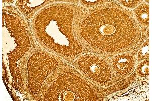 ABIN6262100 and ABIN6268913 at 1/100 staining Rat ovary tissue by IHC-P. (GRP78 Antikörper  (C-Term))