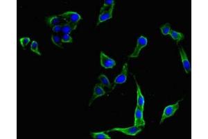 Immunofluorescent analysis of Hela cells using ABIN7175388 at dilution of 1:100 and Alexa Fluor 488-congugated AffiniPure Goat Anti-Rabbit IgG(H+L) (FLT4 Antikörper  (AA 1112-1329))