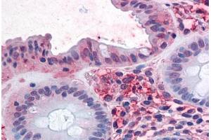Human Colon: Formalin-Fixed, Paraffin-Embedded (FFPE) (SLC1A5 Antikörper  (Internal Region))
